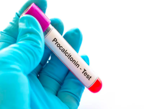 Назначать антибиотики или нет? Прокальцитонин ответит.